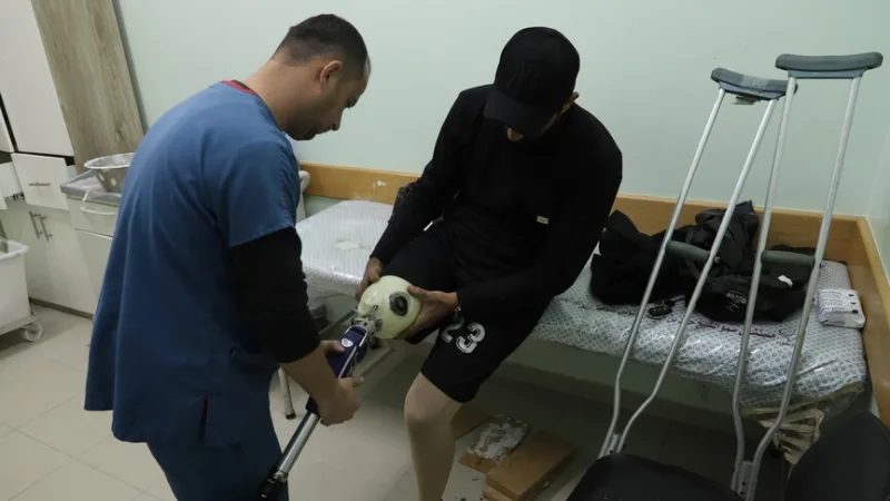 في غزة الخاضعة للحصار الإسرائيلي، ينتظر الفلسطينيون شهورًا للحصول على أطراف اصطناعية