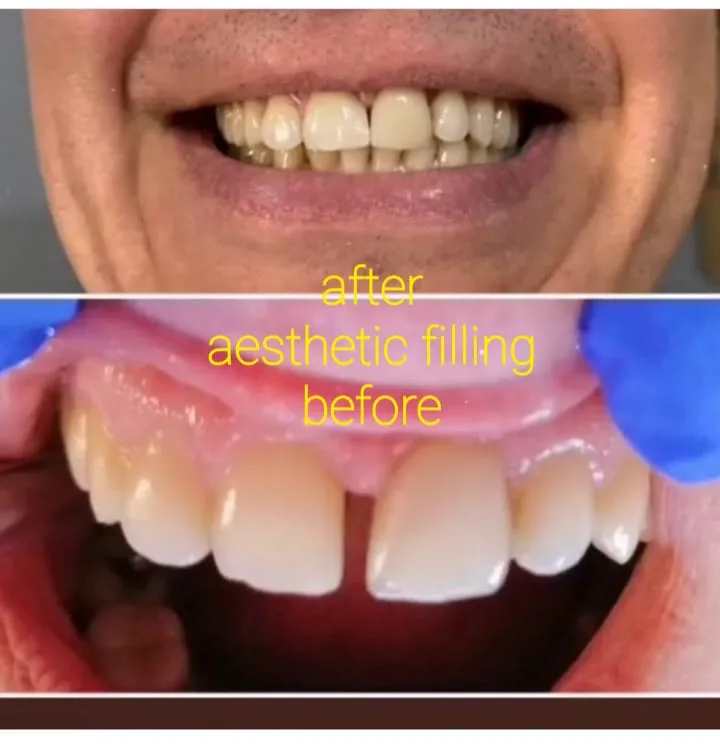 Alanya HEALTHY TEETH Dental Aesthetic — 의학 알란야에서: 온라인 주문, 가격 및 리뷰