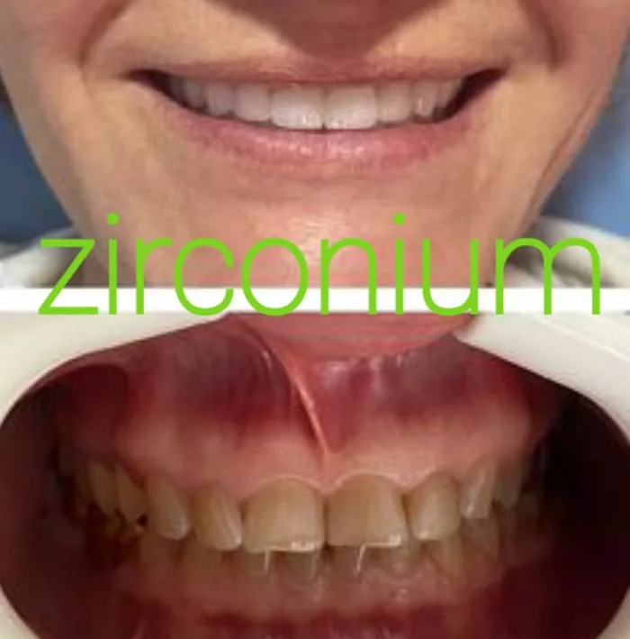 Alanya HEALTHY TEETH Dental Aesthetic — 의학 알란야에서: 온라인 주문, 가격 및 리뷰