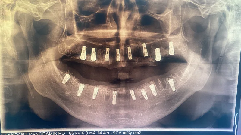 Alanya HEALTHY TEETH Dental Aesthetic — 의학 알란야에서: 온라인 주문, 가격 및 리뷰