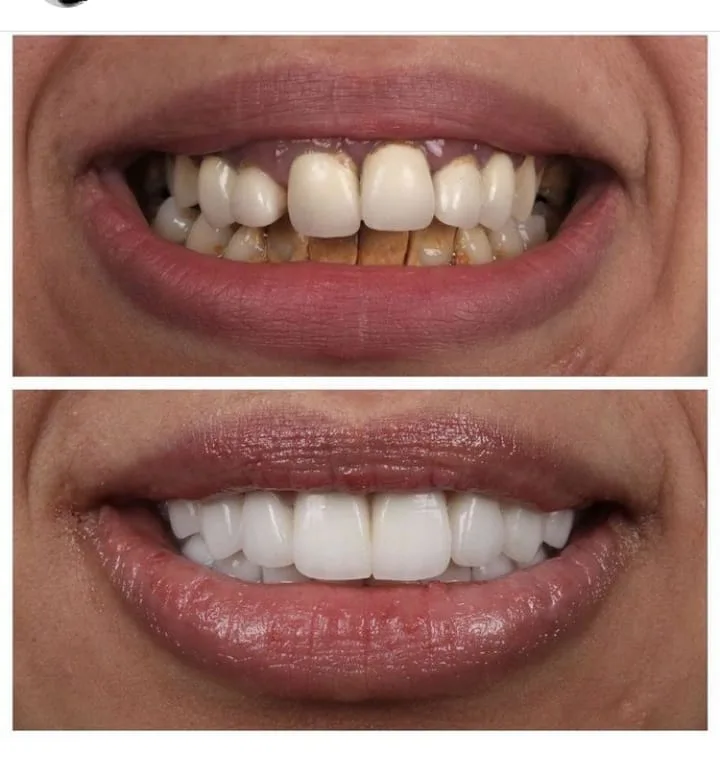 Alanya HEALTHY TEETH Dental Aesthetic — 의학 알란야에서: 온라인 주문, 가격 및 리뷰