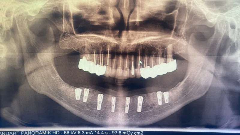 Alanya HEALTHY TEETH Dental Aesthetic — 의학 알란야에서: 온라인 주문, 가격 및 리뷰