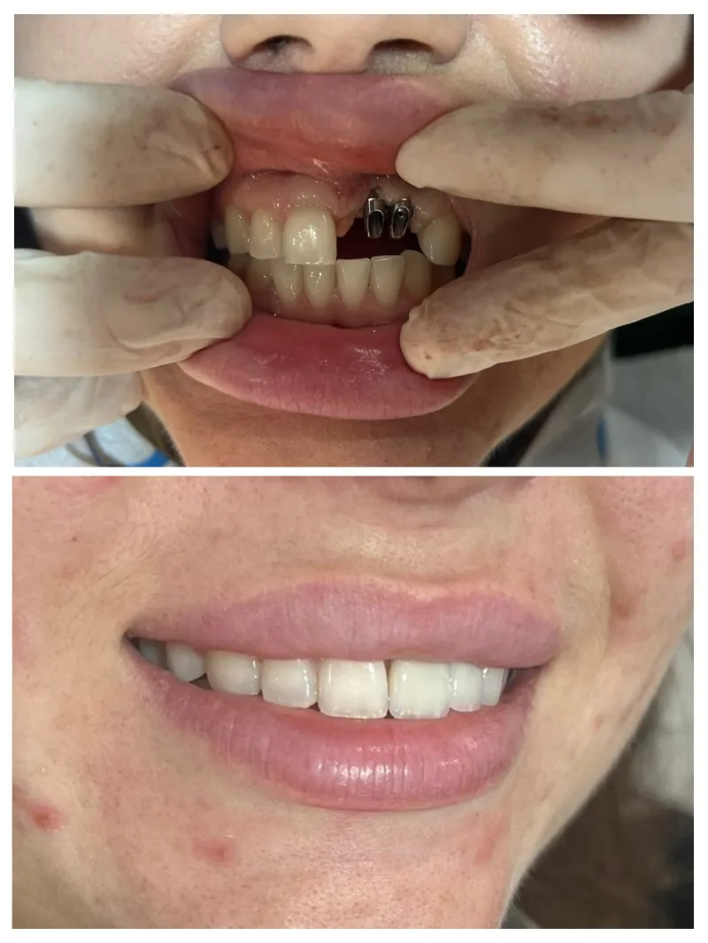 Alanya HEALTHY TEETH Dental Aesthetic — 의학 알란야에서: 온라인 주문, 가격 및 리뷰
