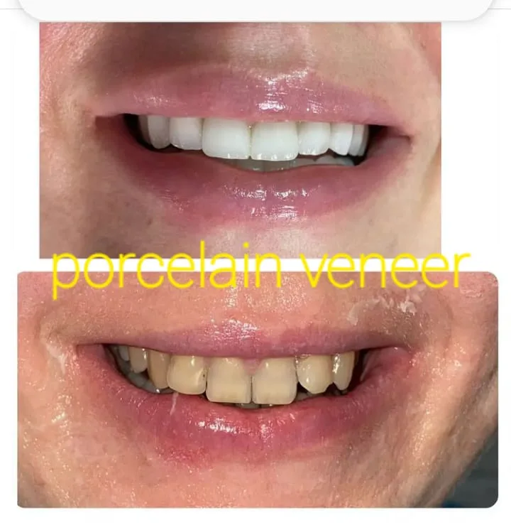 Alanya HEALTHY TEETH Dental Aesthetic — 의학 알란야에서: 온라인 주문, 가격 및 리뷰